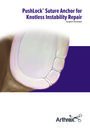 PushLock® - Knotless Instability Repair